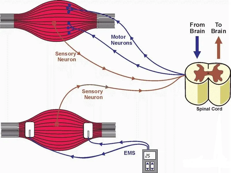 The effect of electrical stimulation on skeletal muscles.png